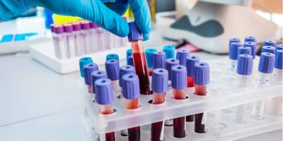 Μικροβιολόγοι - εξετάσεις αίματος, αιμοληψίες κατ' οίκον κτλ.